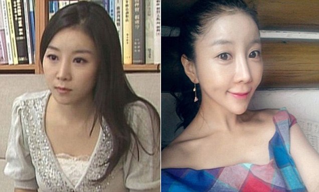 korean-woman-heart-shaped-face-surgery-1