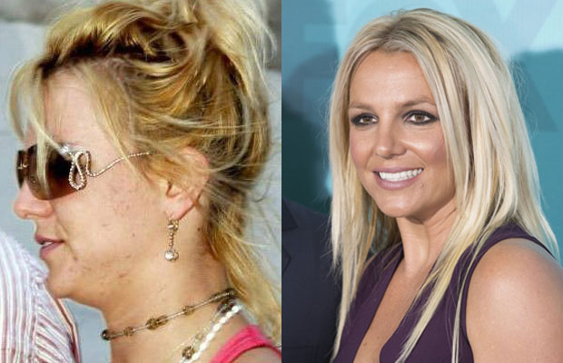 48 Photos Of Celebrities Without Makeup Britney Spears Without Makeup Viralscape
