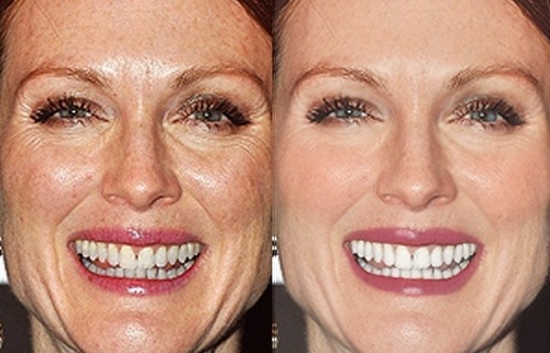Julianne Moore Before & After Photoshop