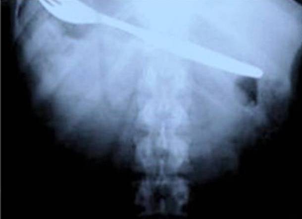 Fork In Body X-Ray