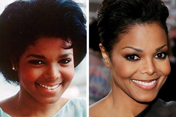 Janet Jackson Before And After Plastic Surgery