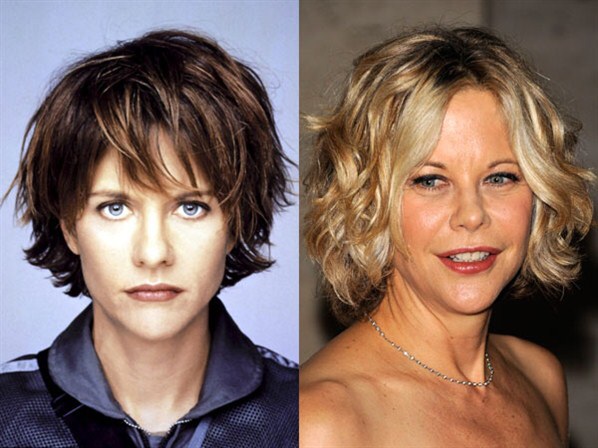 Meg Ryan Before And After Plastic Surgery