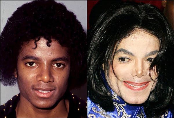 Michael Jackson Before And After Plastic Surgery