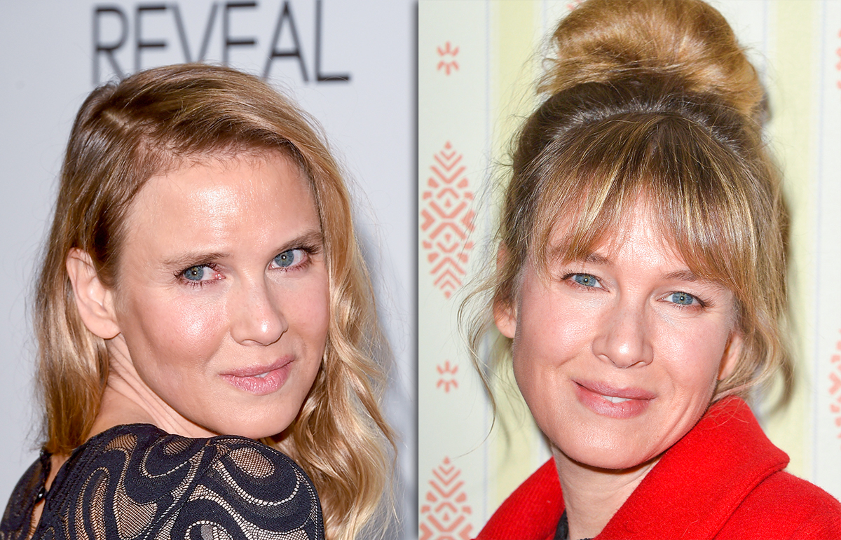 Renee Zellweger S Face Appears To Be Back To Normal